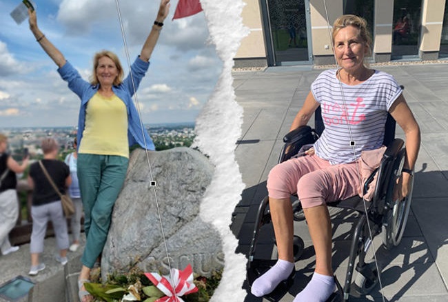 Dwa zdjęcia kobiety, jedne gdy stoi, drugie, gdy siedzi na wózku inwalidzkim